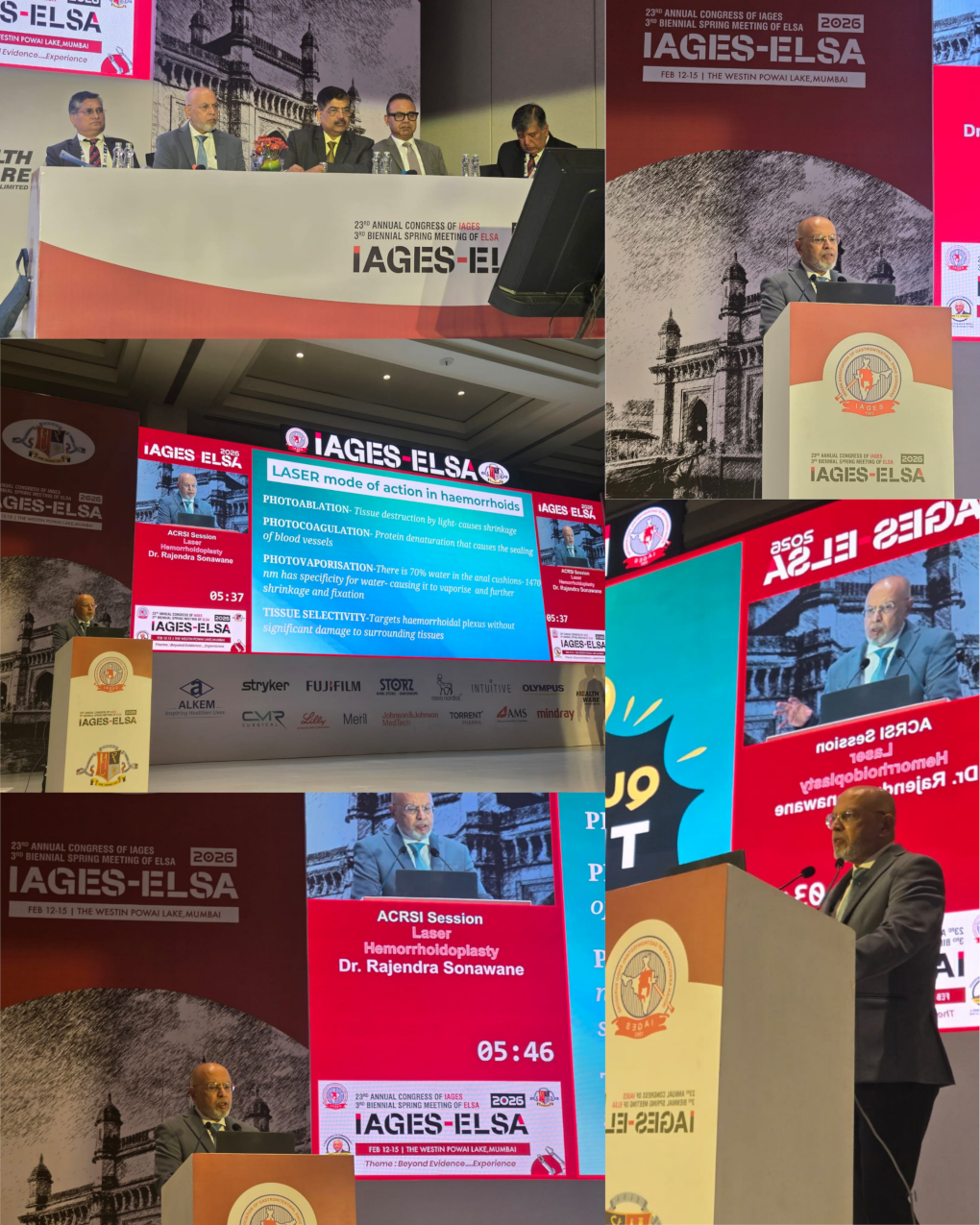 Dr Rajendra Sonavane demonstrating advanced laser piles surgery and sphincterotomy at The Annual Conference and Convocation of Fellowships, The Westin, Mumbai.