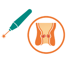 Advanced Laser procedure