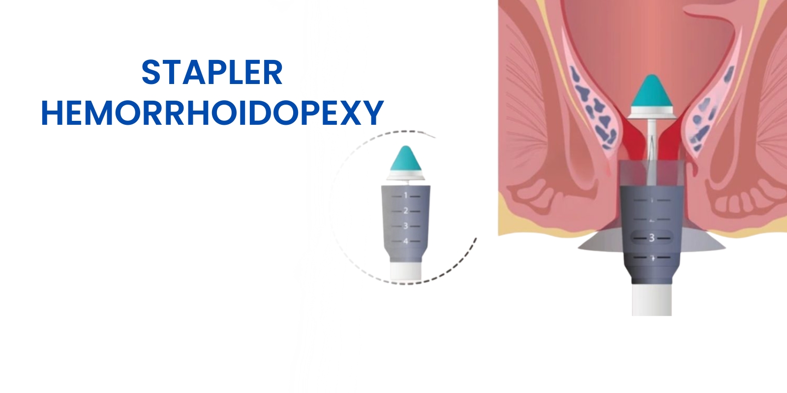 WhatsApp Image 2026 04 07 at 17 45 12 1