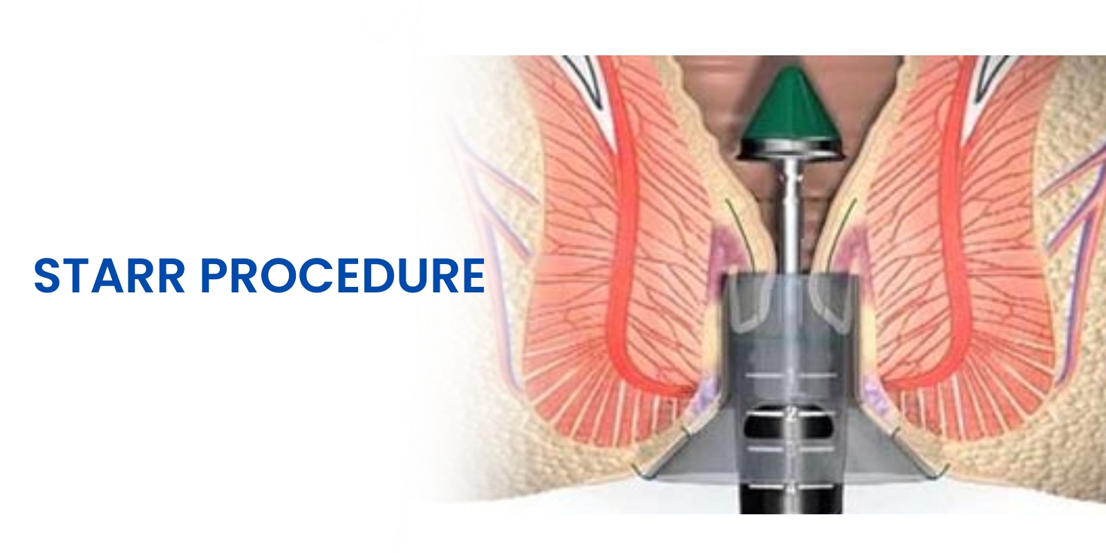 WhatsApp Image 2026 04 07 at 17 53 29